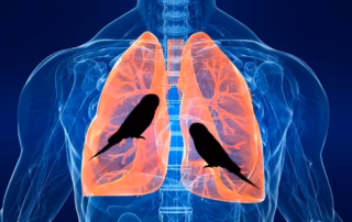 Vogelhaltung trotz Vogelhalterlunge & Asthma: Risiken, Tipps & Hygiene 8 Vogelhalterlunge